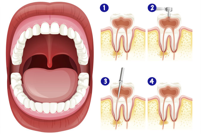 Endodontia