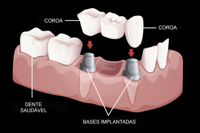 Protocolo